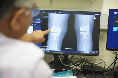 Perfectx Clinical Study
