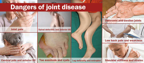 Joint Pain Visual