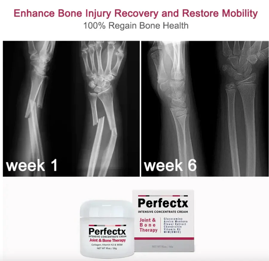 Why Joints Hurt
